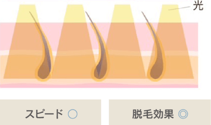 THRの方式