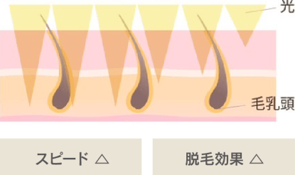 従来の方式